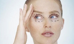 Tipos de blefaroplastia para rexuvenecer a pel arredor dos ollos